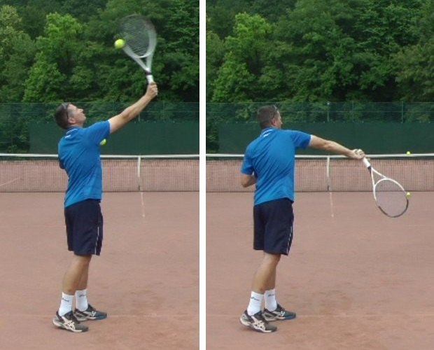 slice-pronation pronate late when serving